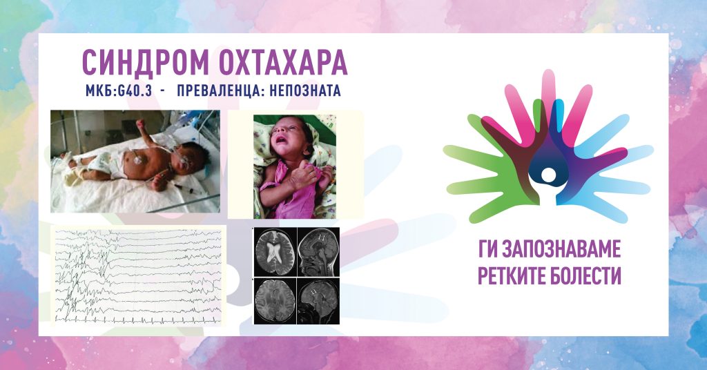 Ги запознаваме ретките болести: Синдром Охтахара Ги запознаваме ретките болести: Синдром Охтахара