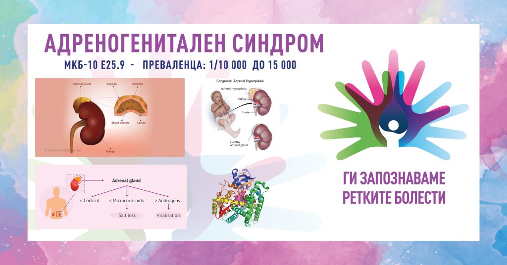 Ги запознаваме ретките болести: Конгенитална адренална хиперплазија/адреногенитален синдром