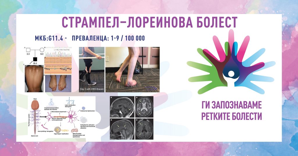 Ги запознаваме ретките болести: Хередитарна спастична параплегија / стрампел–лореинова болест
