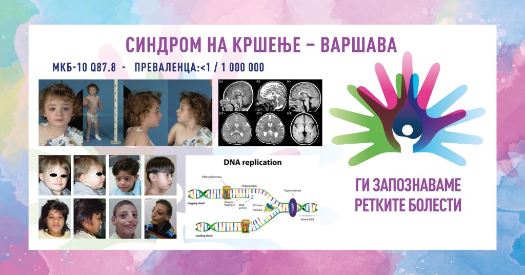 Ги запознаваме ретките болести: Синдром на кршење – Варшава