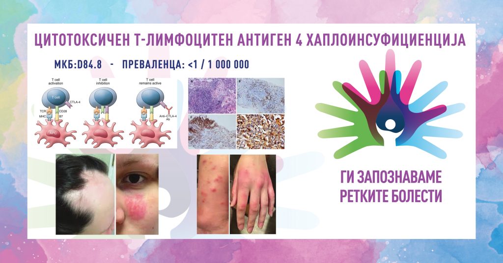 Ги запознаваме ретките болести: Цитотоксичен т-лимфоцитен антиген 4 хаплоинсуфициенција